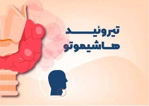 علایم یک بیماری خودایمنی شایع بر اثر اختلالات تیروئیدی را بشناسید